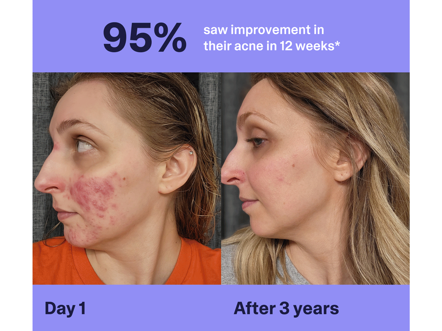 Before and after