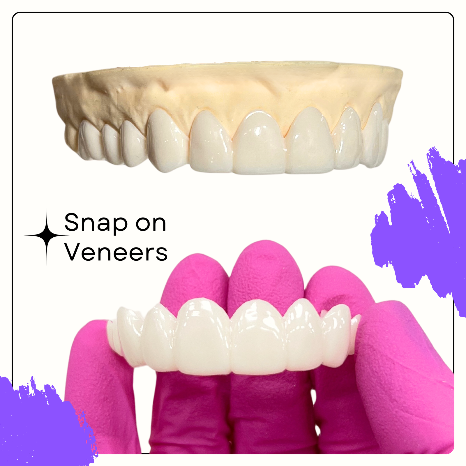 Smile Boutique NY Snap On Removable Veneers