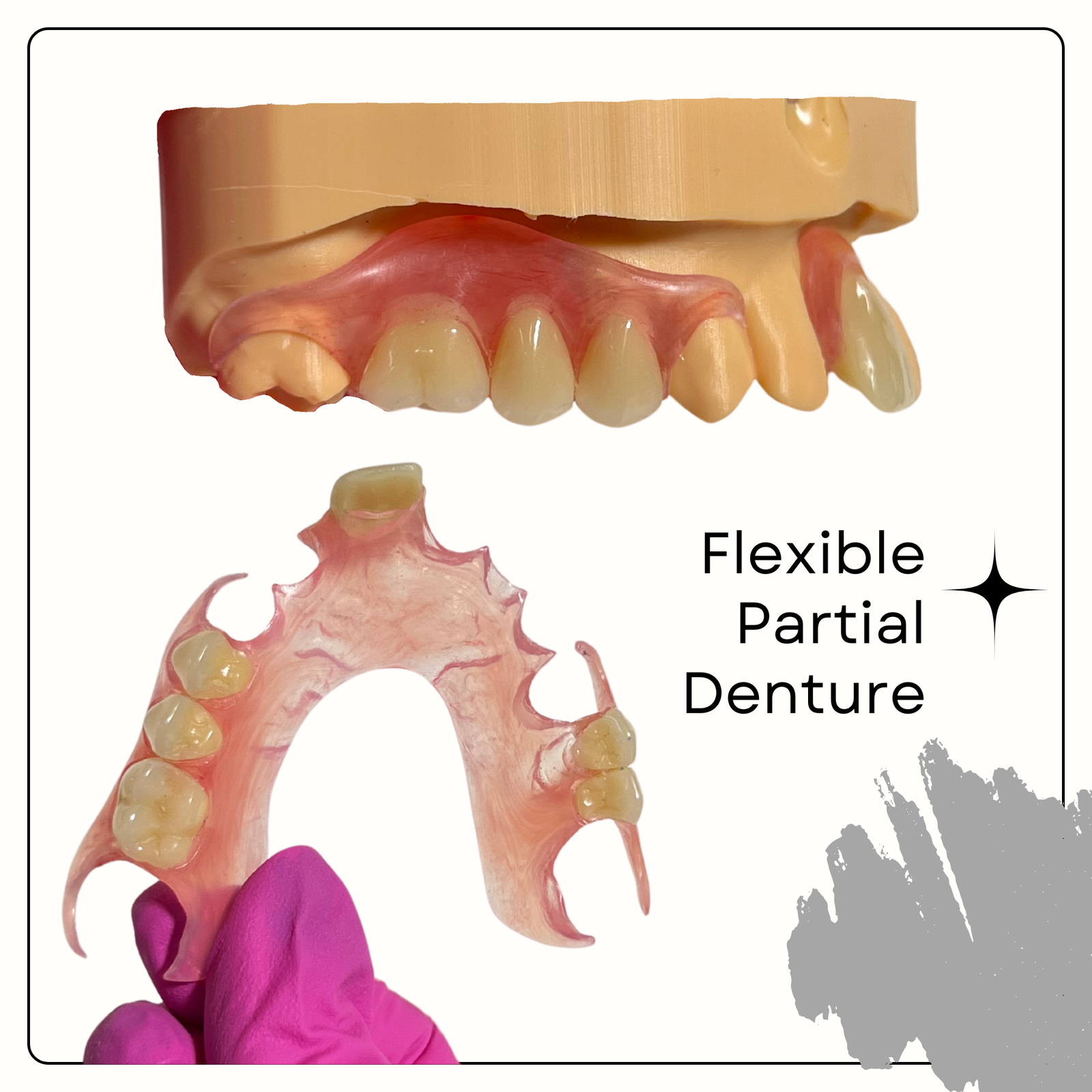 Smile Boutique NY Flexible Denture