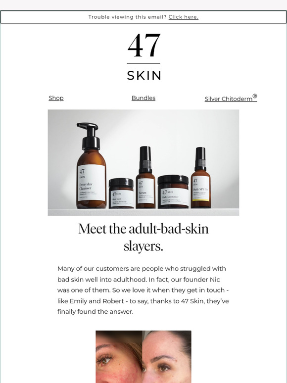 Bye bye, bad (adult) skin 👋