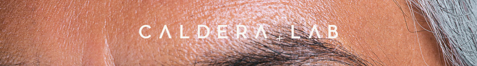 Caldera + Lab