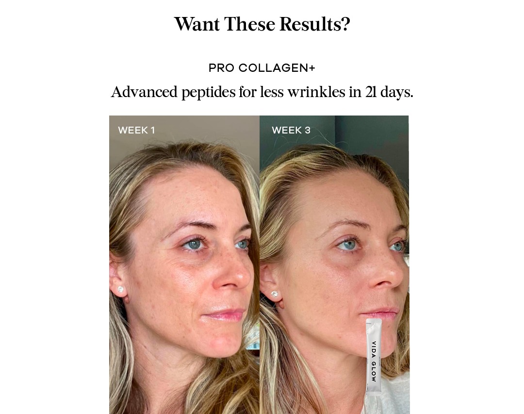 Pro Collagen+