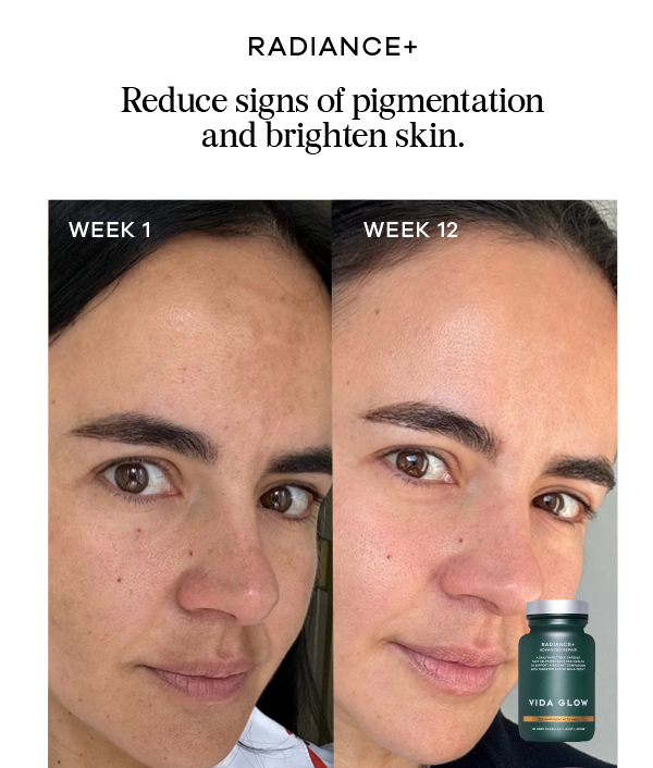 Before After - Radiance+