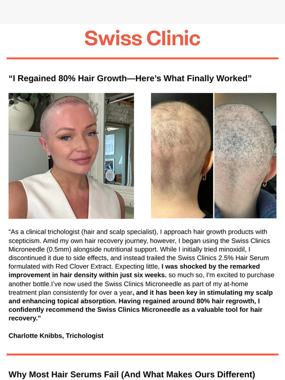 The Secret to My 80% Hair Growth, According to a Trichologist