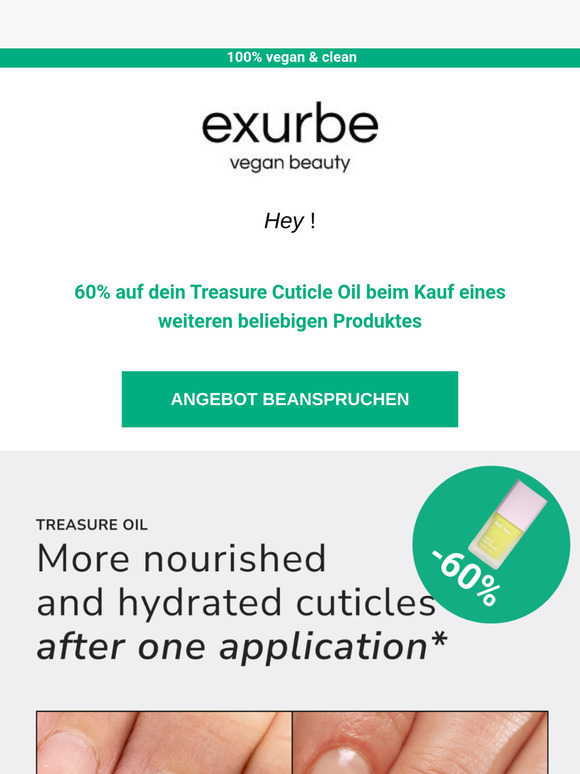 🌿NEU! Gesünder, stärker, schöner – Verjünge deine Nägel mit dem Treasure Oil!