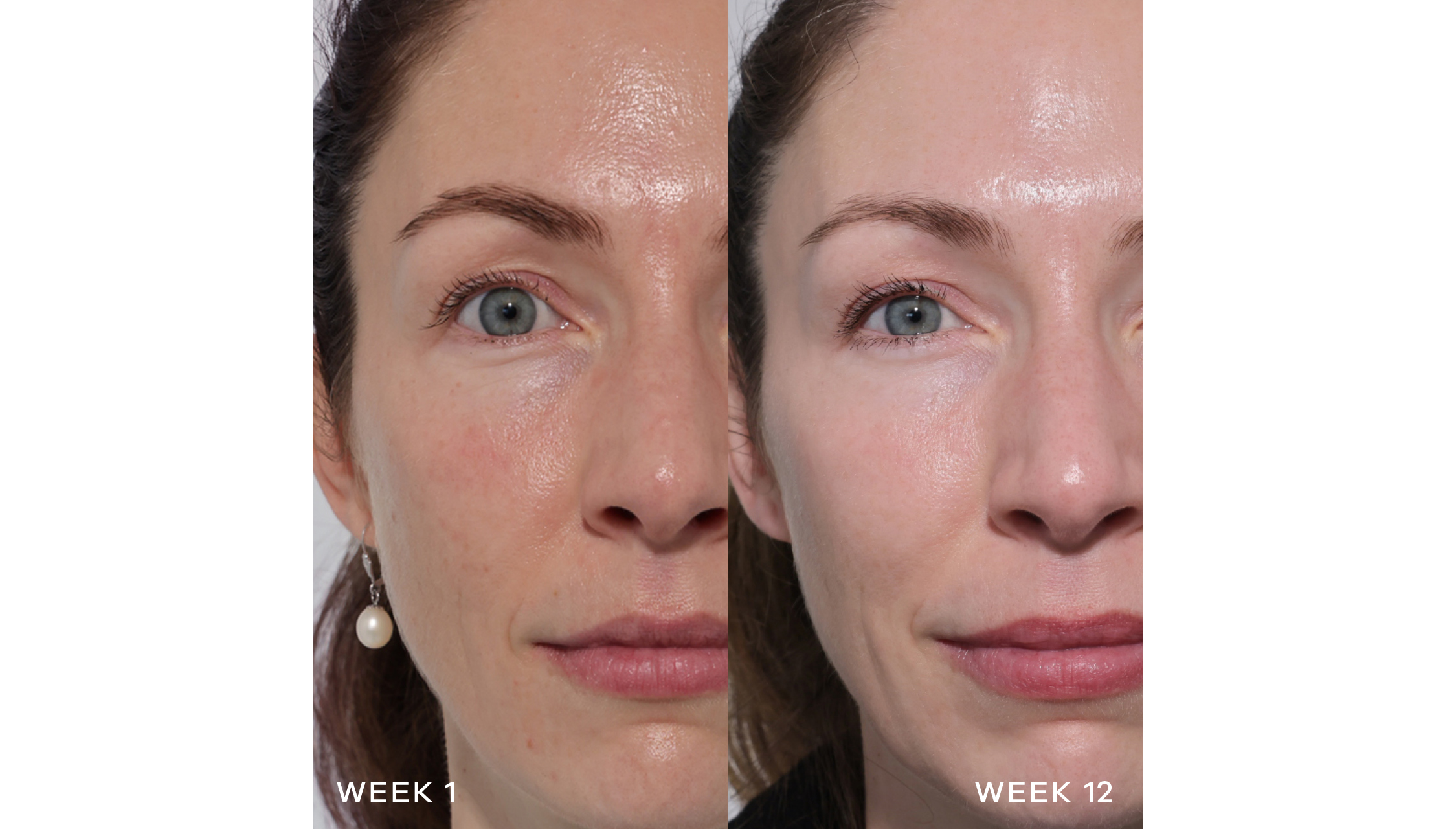 Pro Collagen+