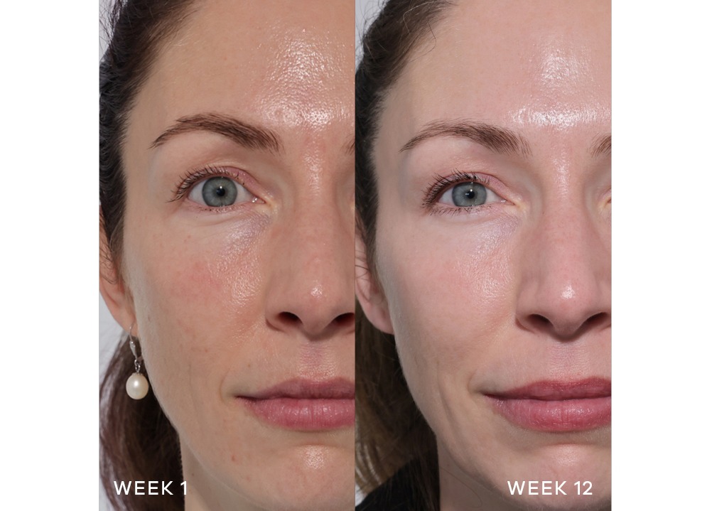 Pro Collagen+