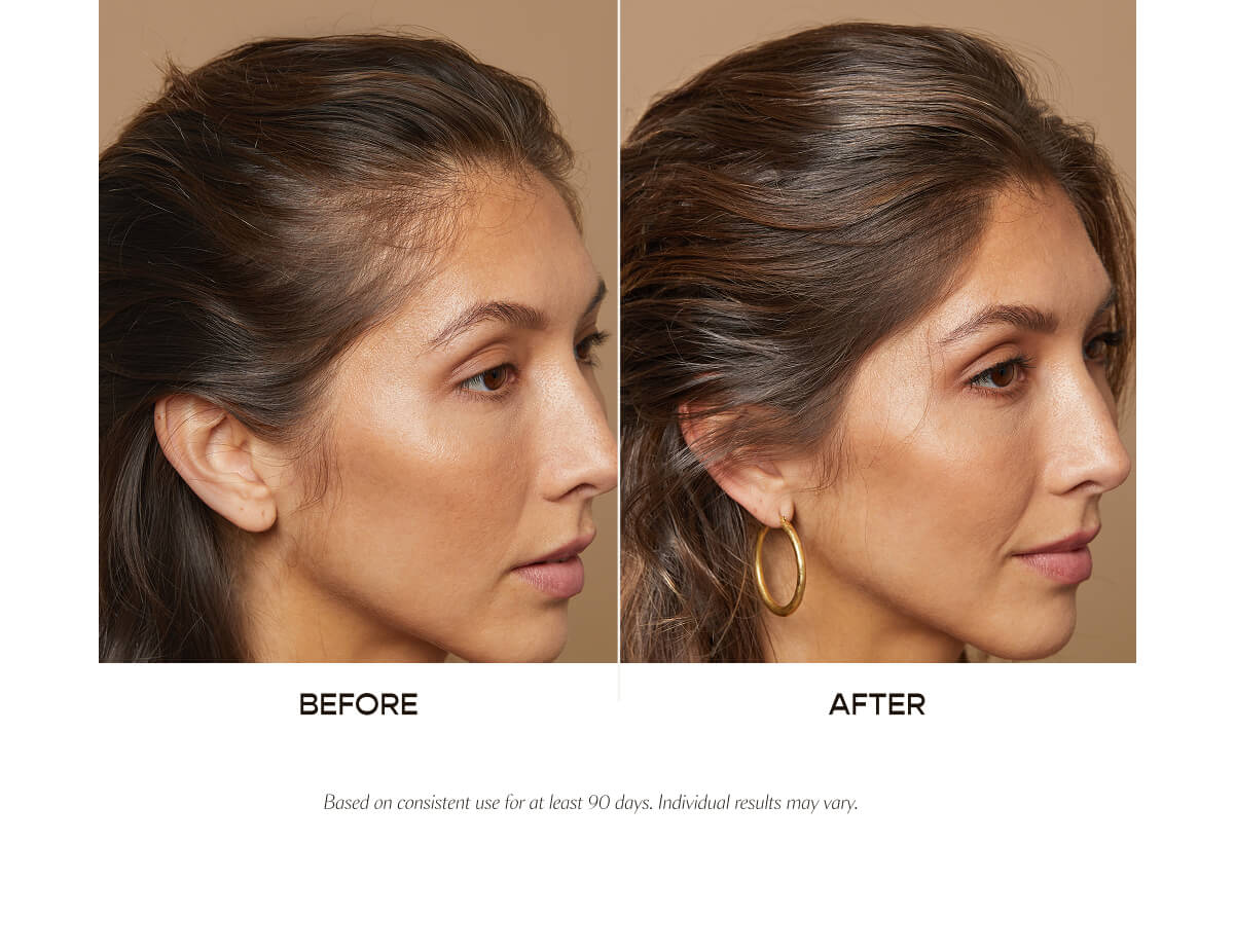 Before and After