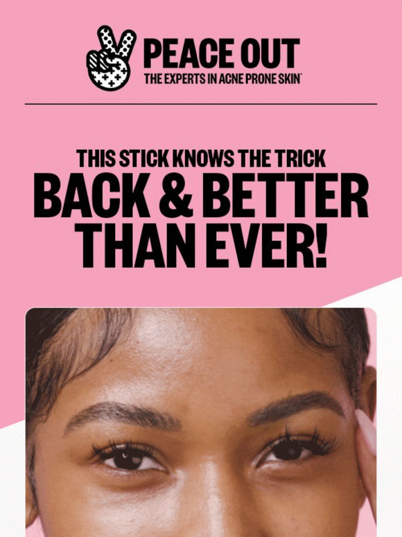 ✨ Swipe Right for Brighter Eyes