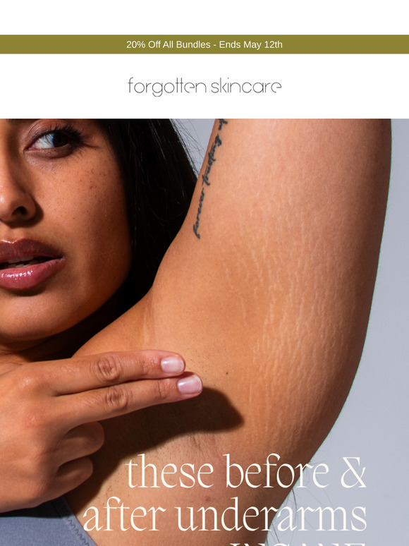 They're getting brighter underarms!