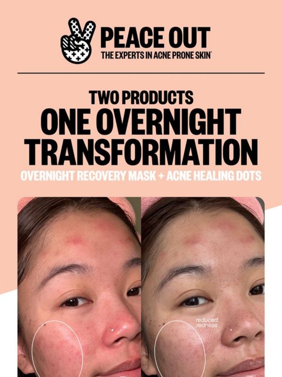 She Used These 2 Products — Look What Happened Overnight 👀