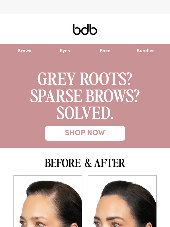 Your Greys Are Showing?