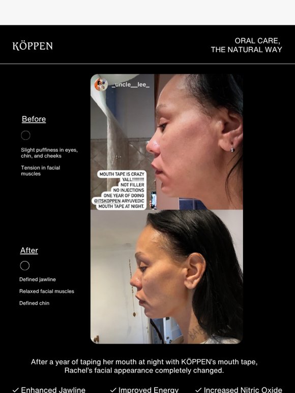 A Before & After You Have To See