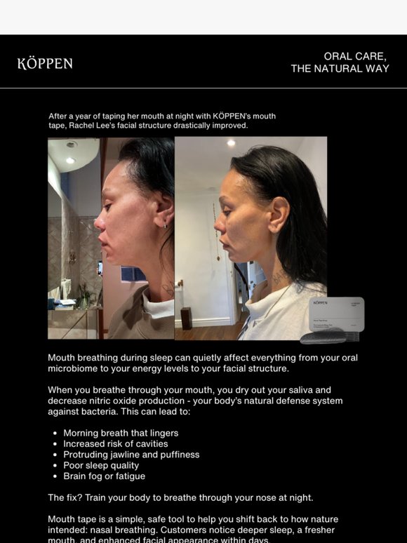 What Using Mouth Tape Does To Your Face