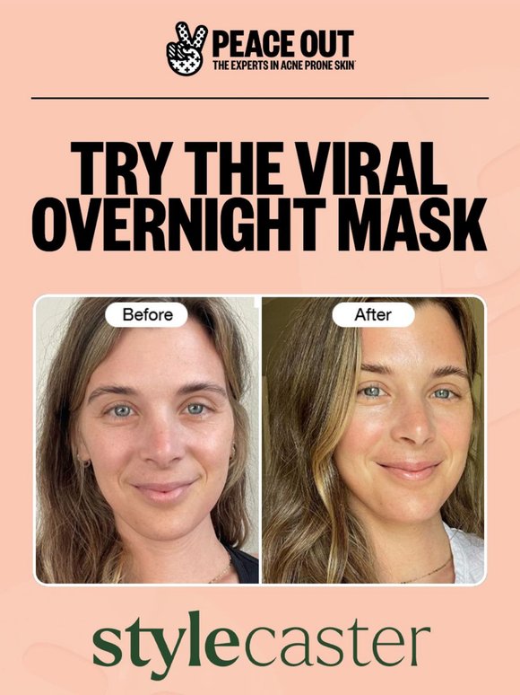 The Overnight Mask StyleCaster Is Raving About 😴✨