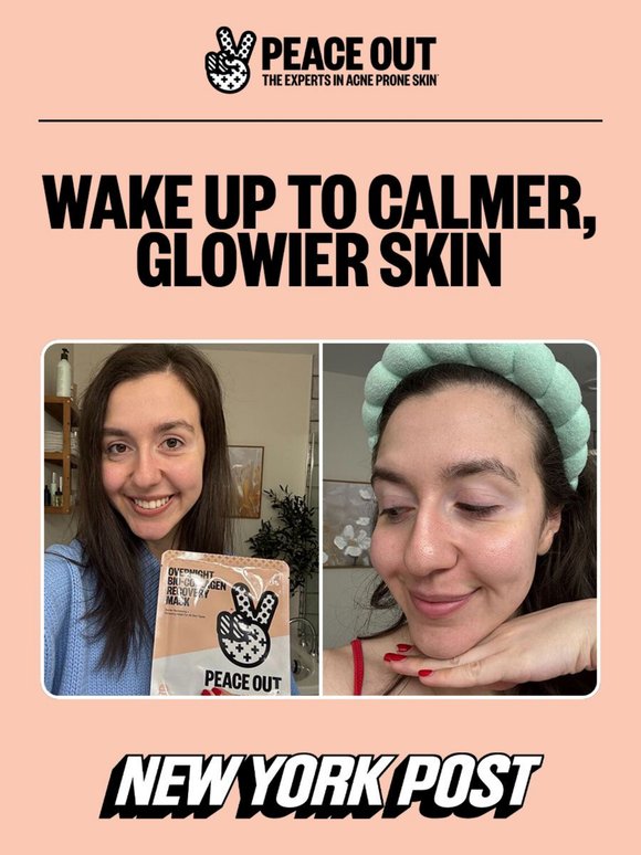 NY Post Loves the Skin-Calming Power of This Mask 🧖‍♀️✨