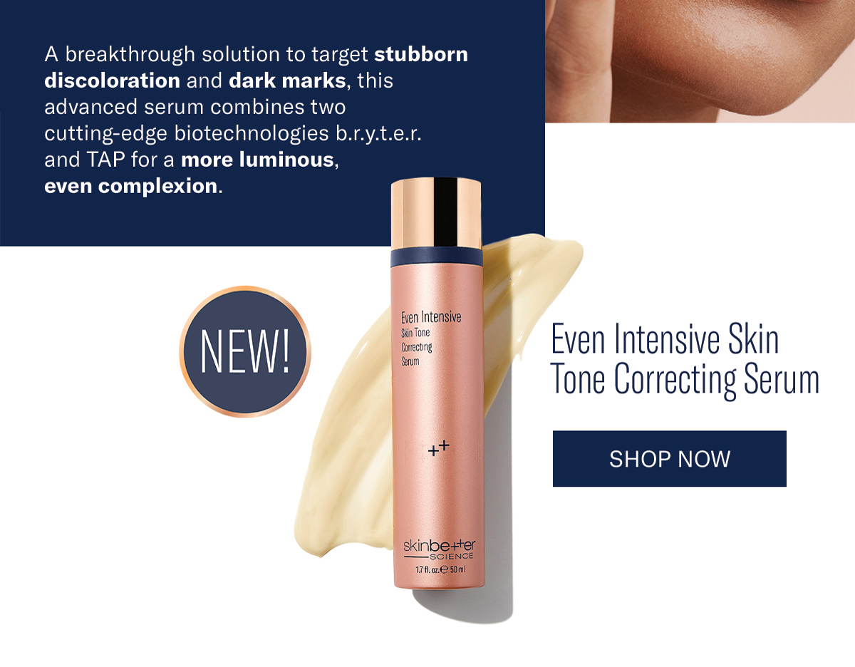 even intensive
