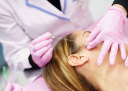 PDO Thread Lift at Skinovatio Gold Coast (Up to 58% Off) 