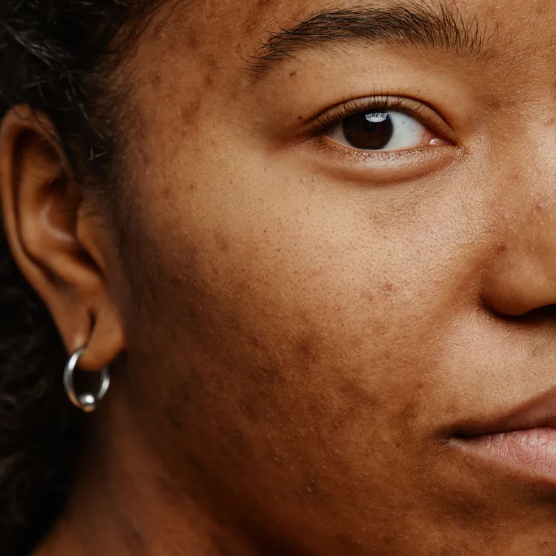 We Tested Dark Spot Correctors for Months. These 3 Actually Worked
