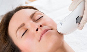 Brighten Your Skin with 1 or 2 IPL Photofacials