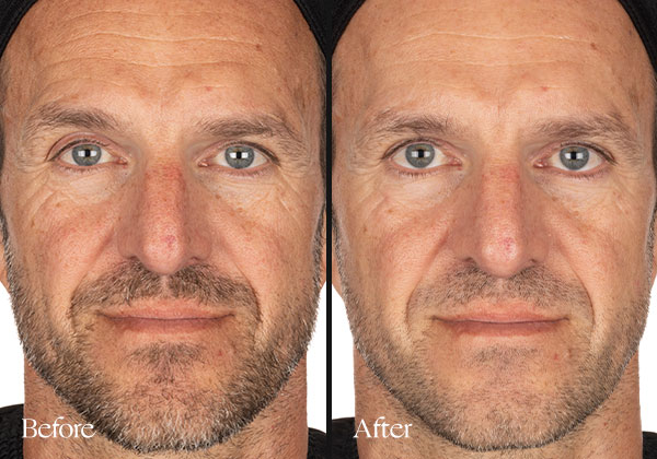 Clinically proven to brighten, even skin tone, and refine texture