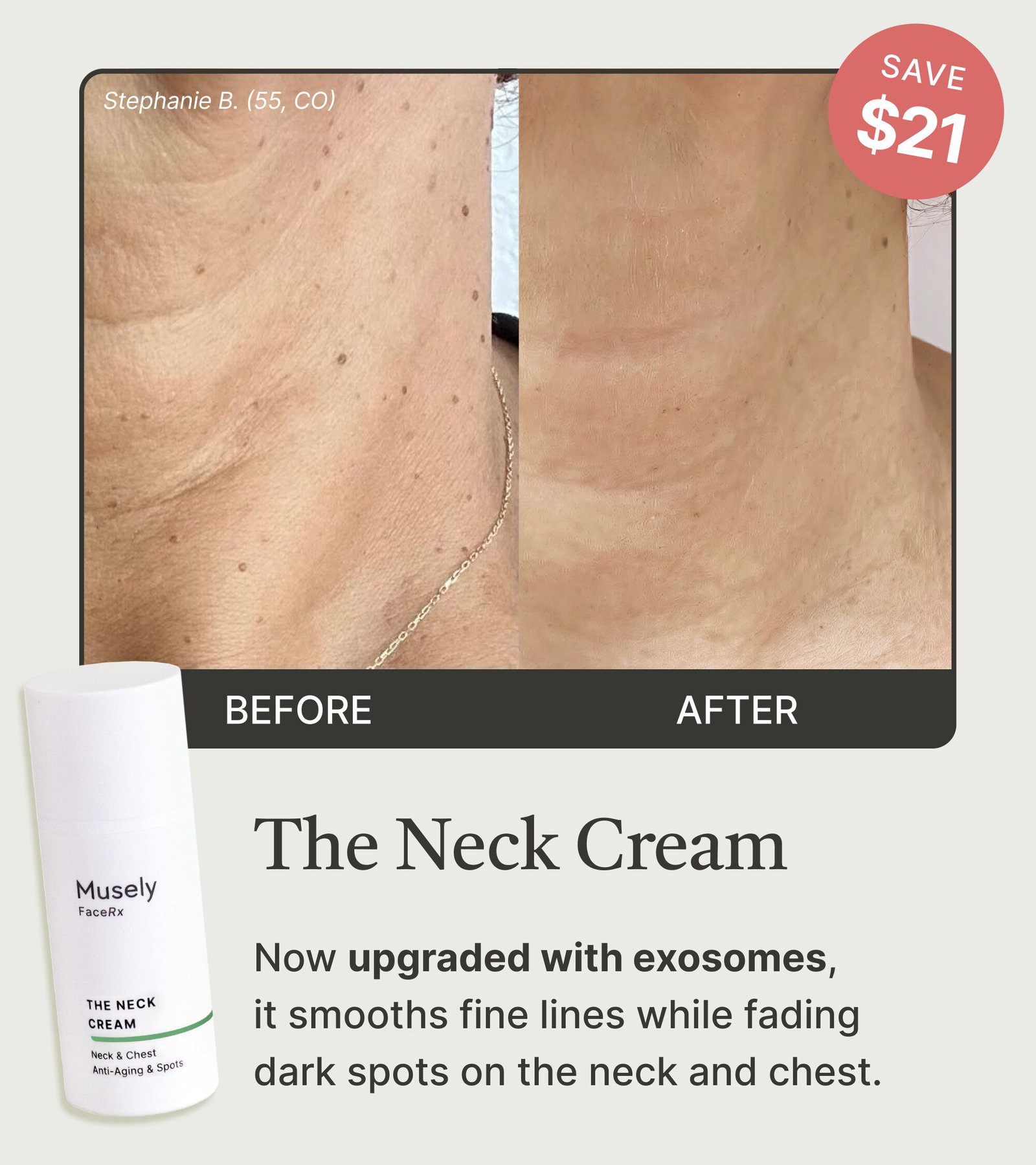 The Neck Cream