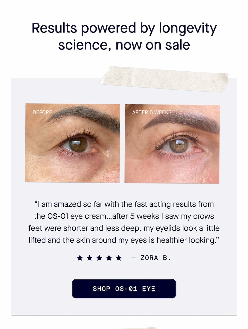 5 star review for OS-01 Eye - Shop Now 