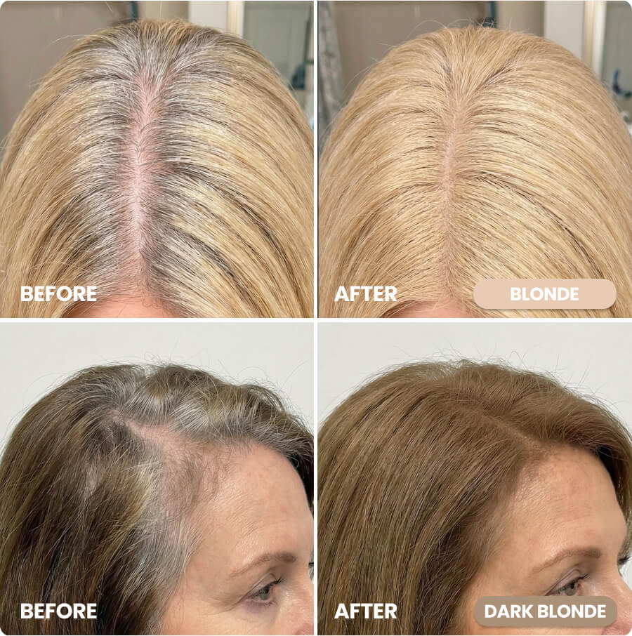 Before and After Instant Coverage Hairline Powder