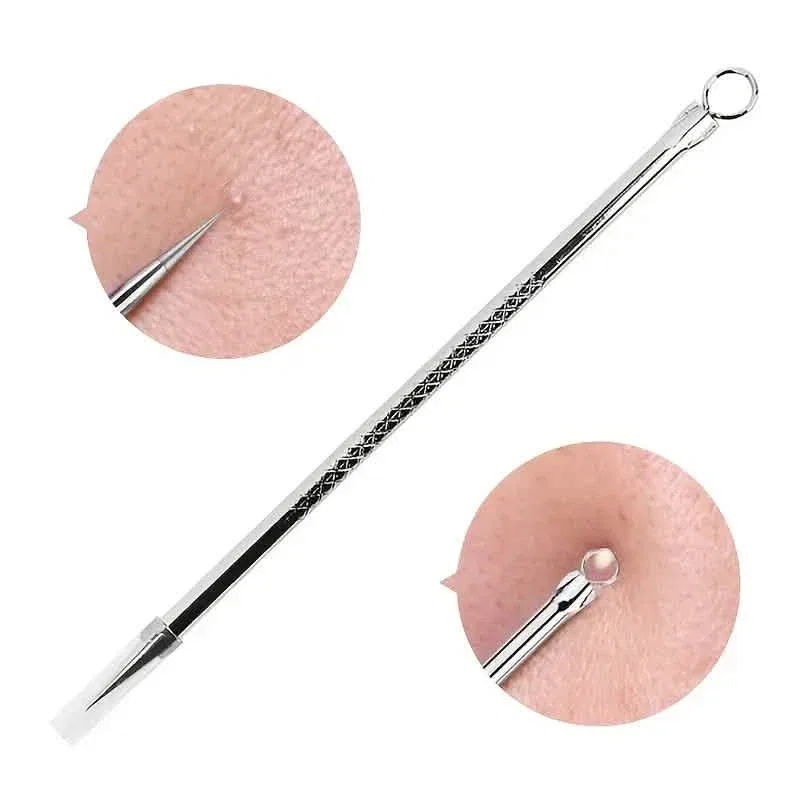 Image of Stainless Steel Pimple Extractor Blackhead Removal Tool For Blemish Whitehead Popping Acne