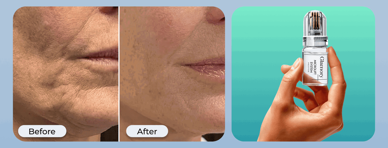 Glamory  Microlift System  Micro-needle system that delivers ingredients into the skin for anti-aging results