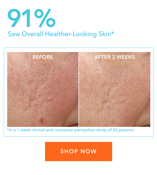 Alpha Beta Ultra Gentle Daily Peel Results