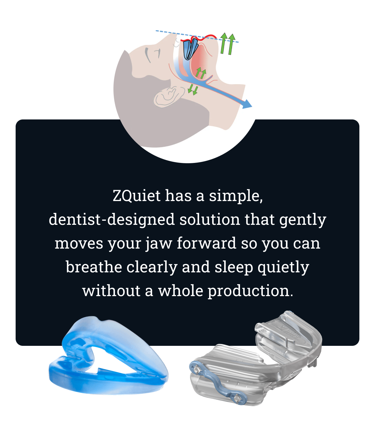  ZQuiet has a simple, dentist-designed solution that gently moves your jaw forward so you can breathe clearly and sleep quietly without a whole production. 