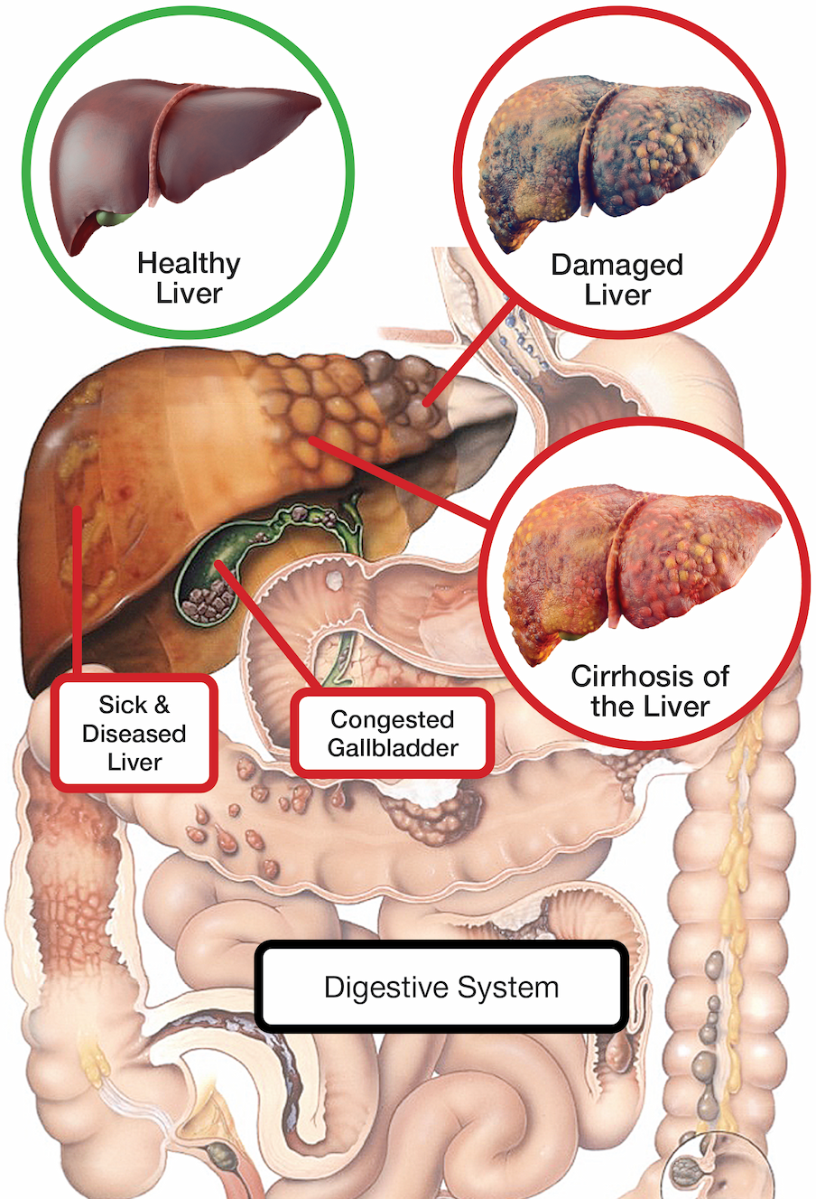 Cleanse and protect your liver and triple your energy
