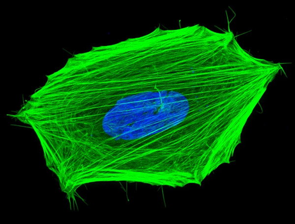 A cancer cell (nucleus in blue, cellular ‘skeleton’ in green).