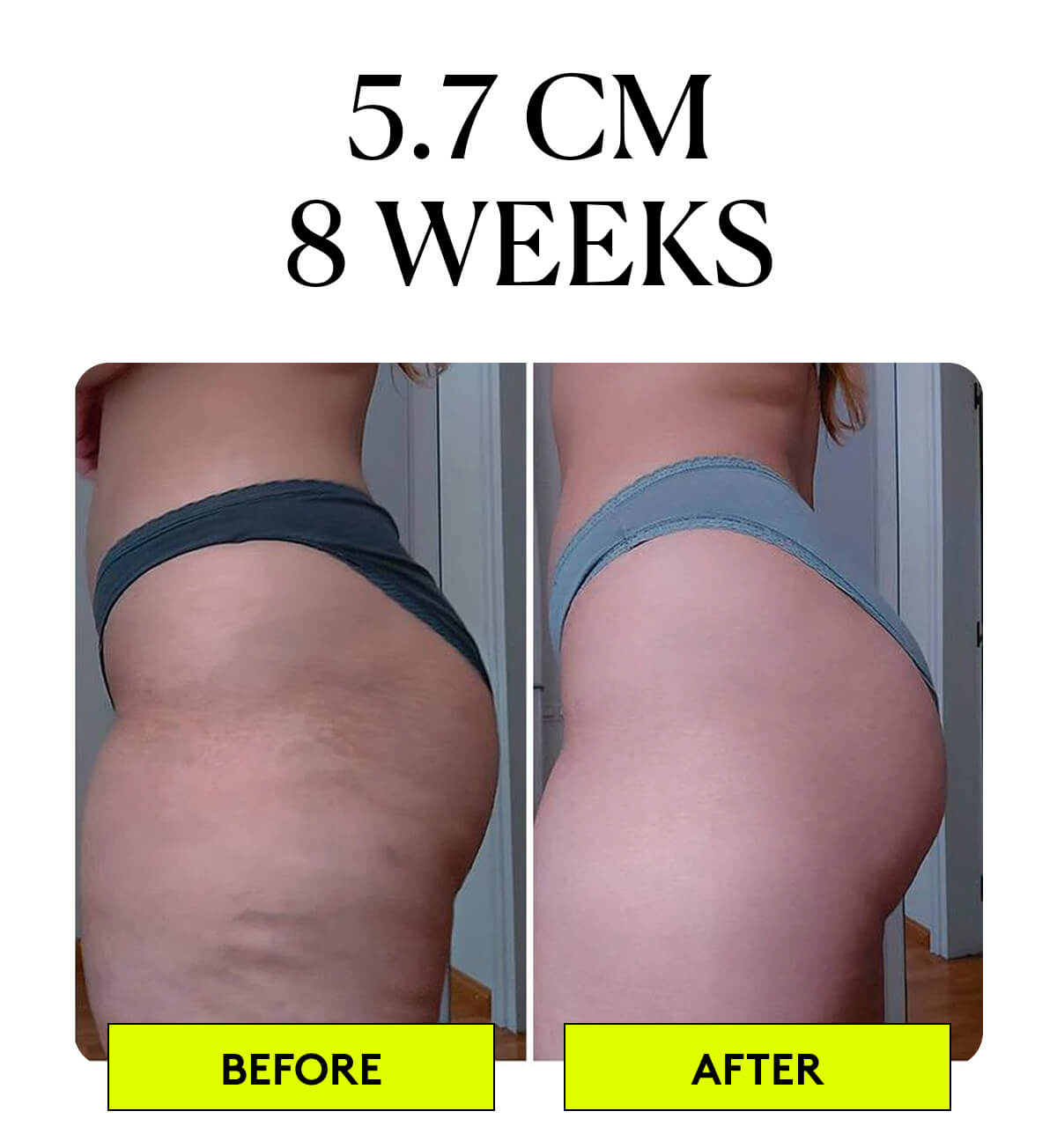 5.7 CM 8 WEEKS