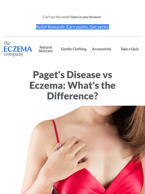 Worried About Itchy Red Skin on Breasts?