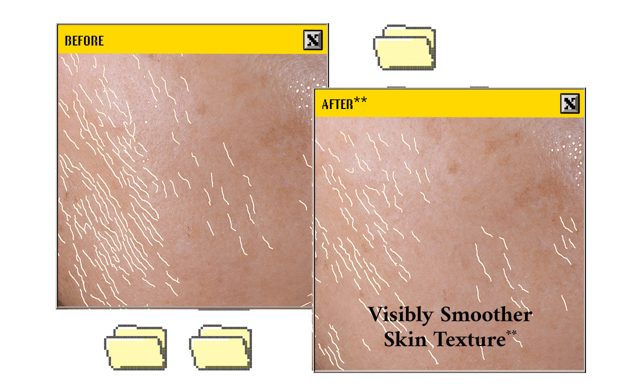BEFORE - AFTER - Visibly Smoother Skin Texture**