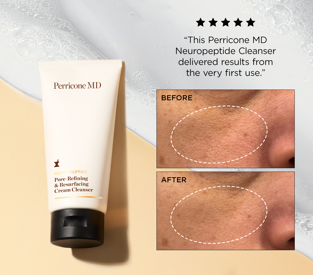 five star review of the cream cleanser