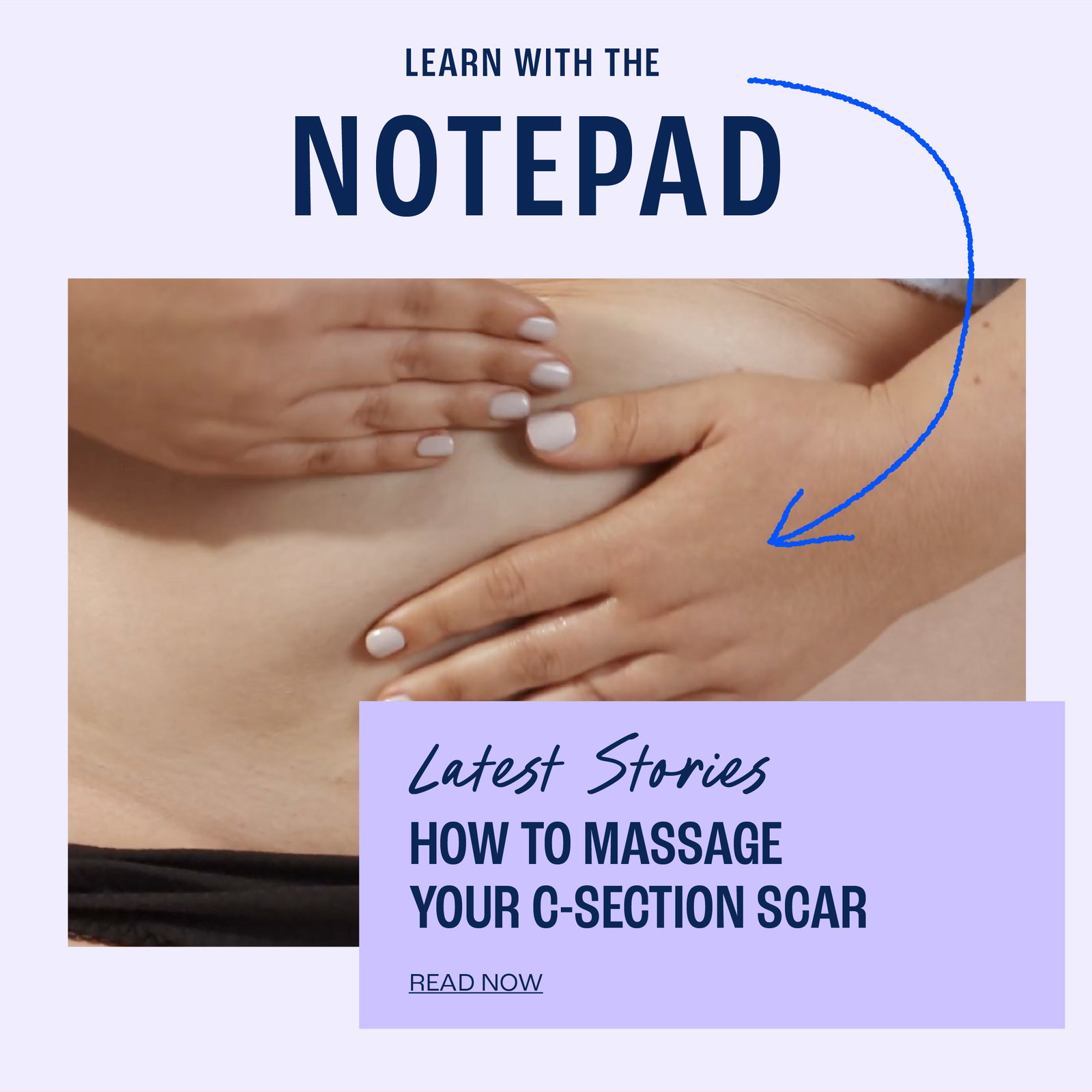 How to massage your C-Section. Read now.
