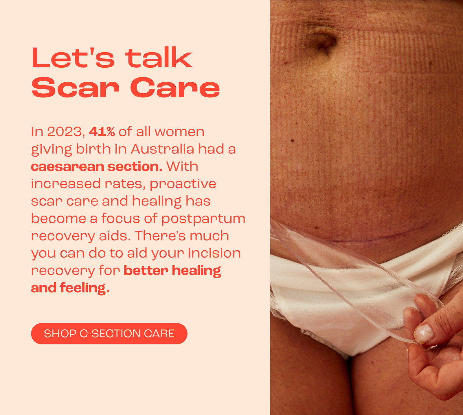 Let's talk scar care. Shop C-section care