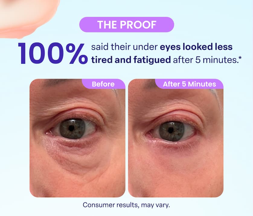 THE PROOF 100% said their under eyes looked less tired and fatigued after 5 minutes.* Consumer results, may vary.
