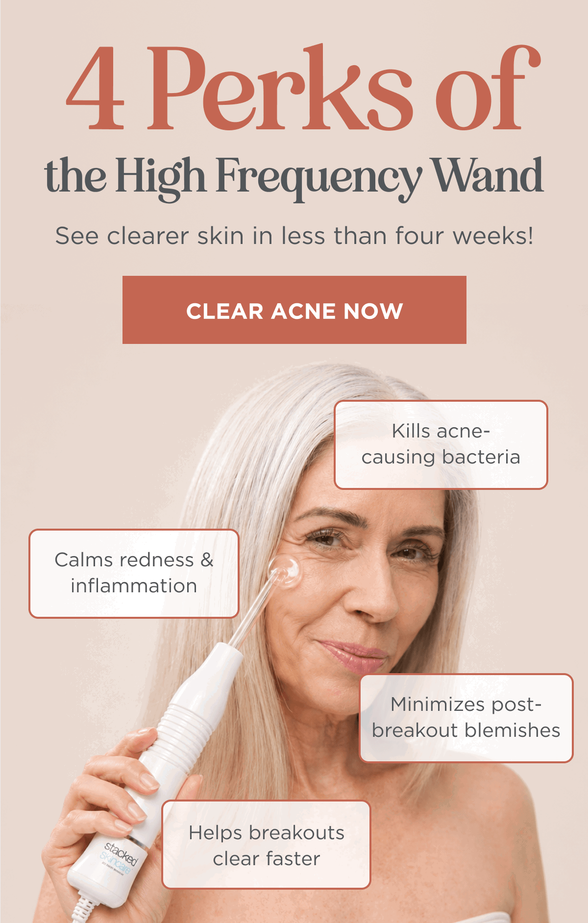 4 Perks of the High Frequency Wand