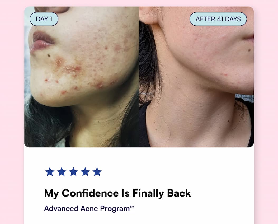 Day 1, After 41 Days