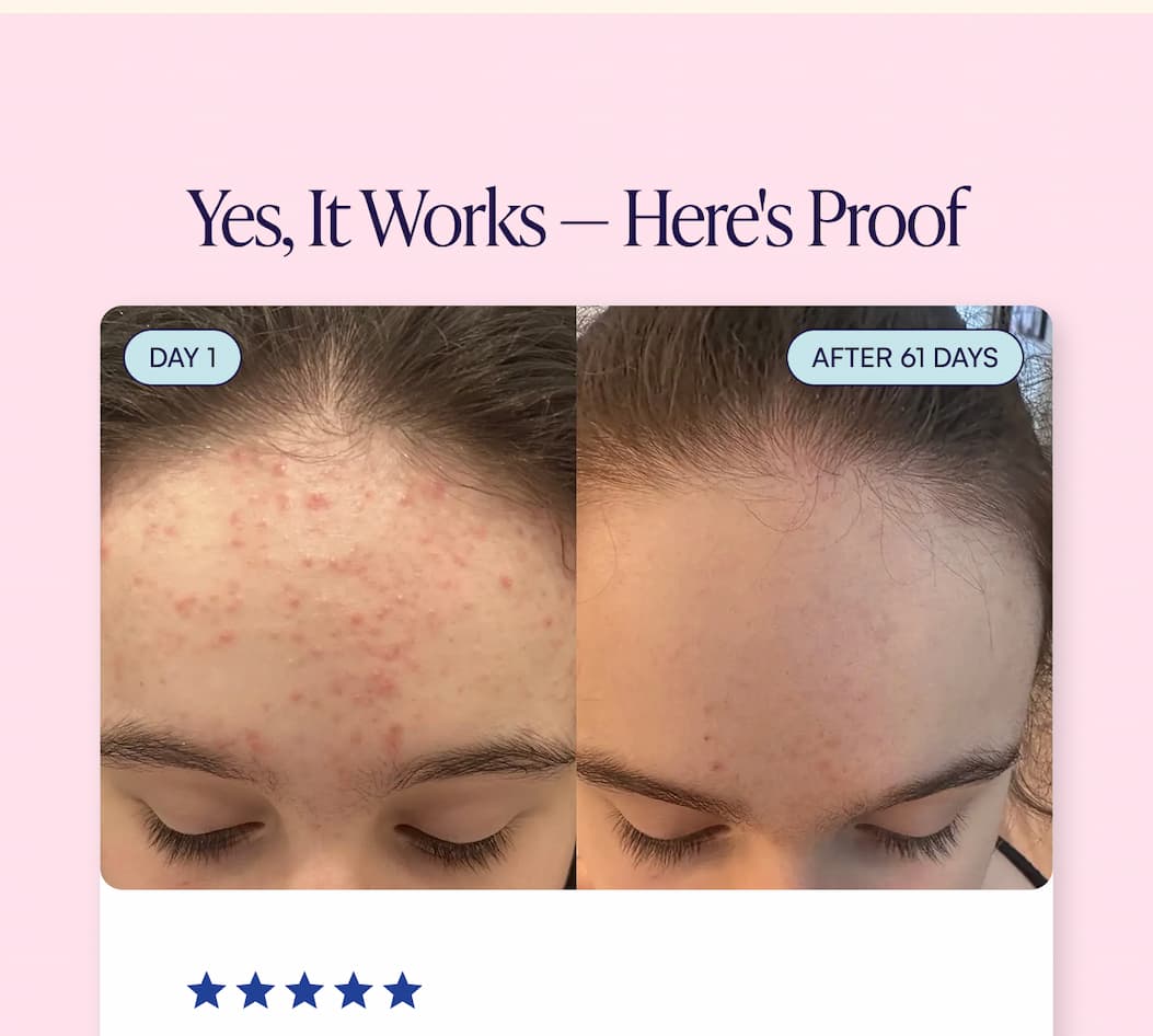 Yes, It Works - Here's Proof