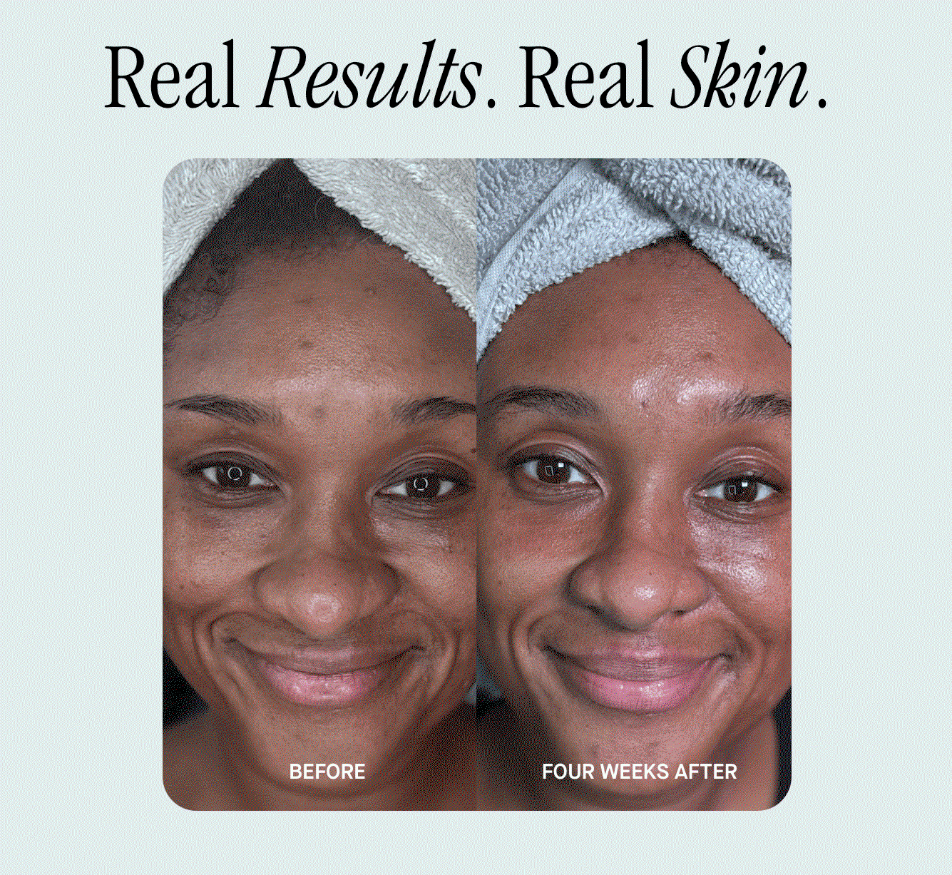 Real Results. Real Skin. 