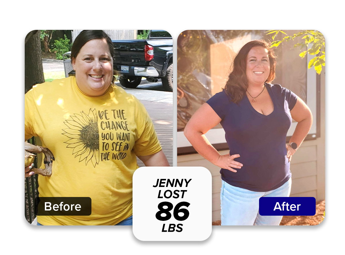 before and after Jenny Lost 86 lbs