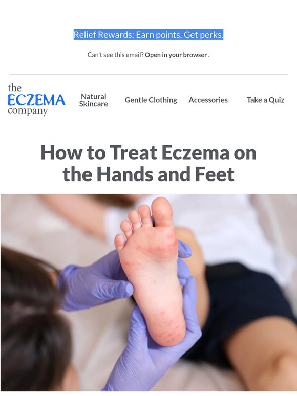 Ouch! Itchy Blisters on Your Hands and Feet?