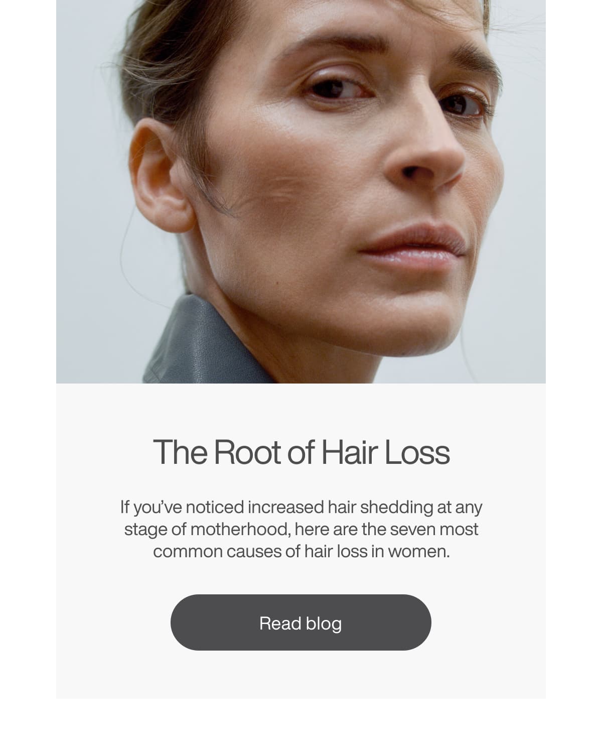 The Root of Hair Loss If you’ve noticed increased hair shedding at any stage of motherhood, here are the seven most common causes of hair loss in women.