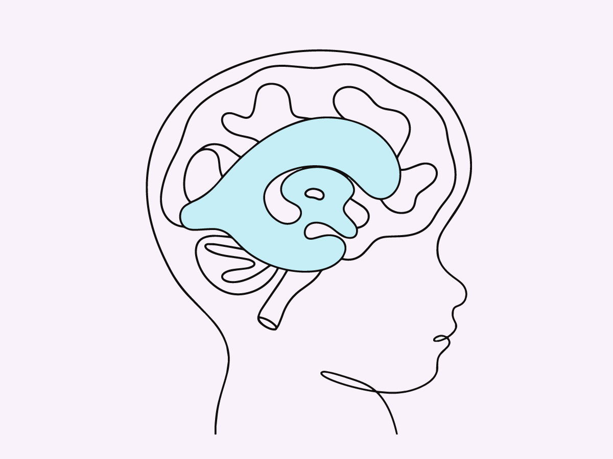 Illustration of brain in child with hydrocephalus