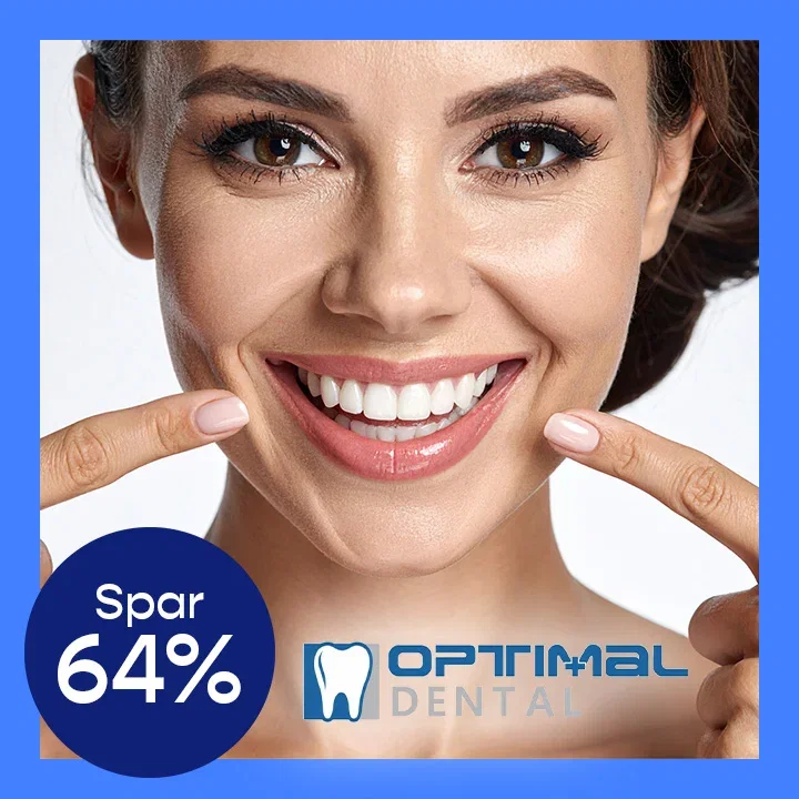 Tannbleking av en eller begge kjever inkl. undersøkelse og rens hos Optimal Dental